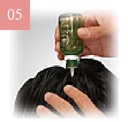 育毛剤の塗布写真