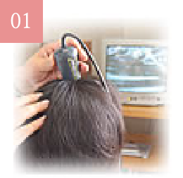 スコープで頭皮の状態をチェックしている写真